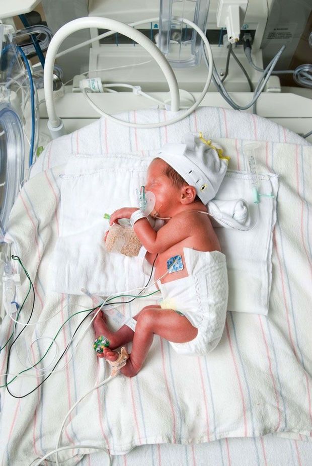 nicu 101 what is the nicu really like 